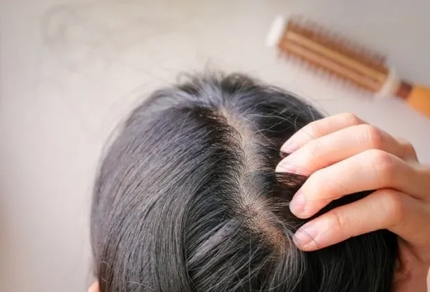 "탈모 고민에 약 먹다가…" 치과의사 면허 정지된 사연