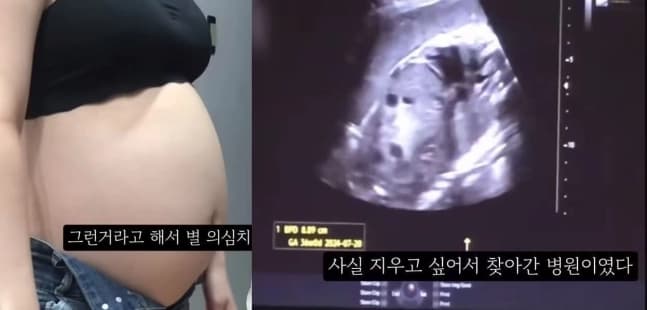 ‘36주차 낙태’ 경찰 “엄중수사”·전문가 “살인죄 가능성”…단순 ‘비만’ 가능성도